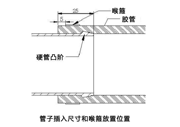 喉箍安装使用标准